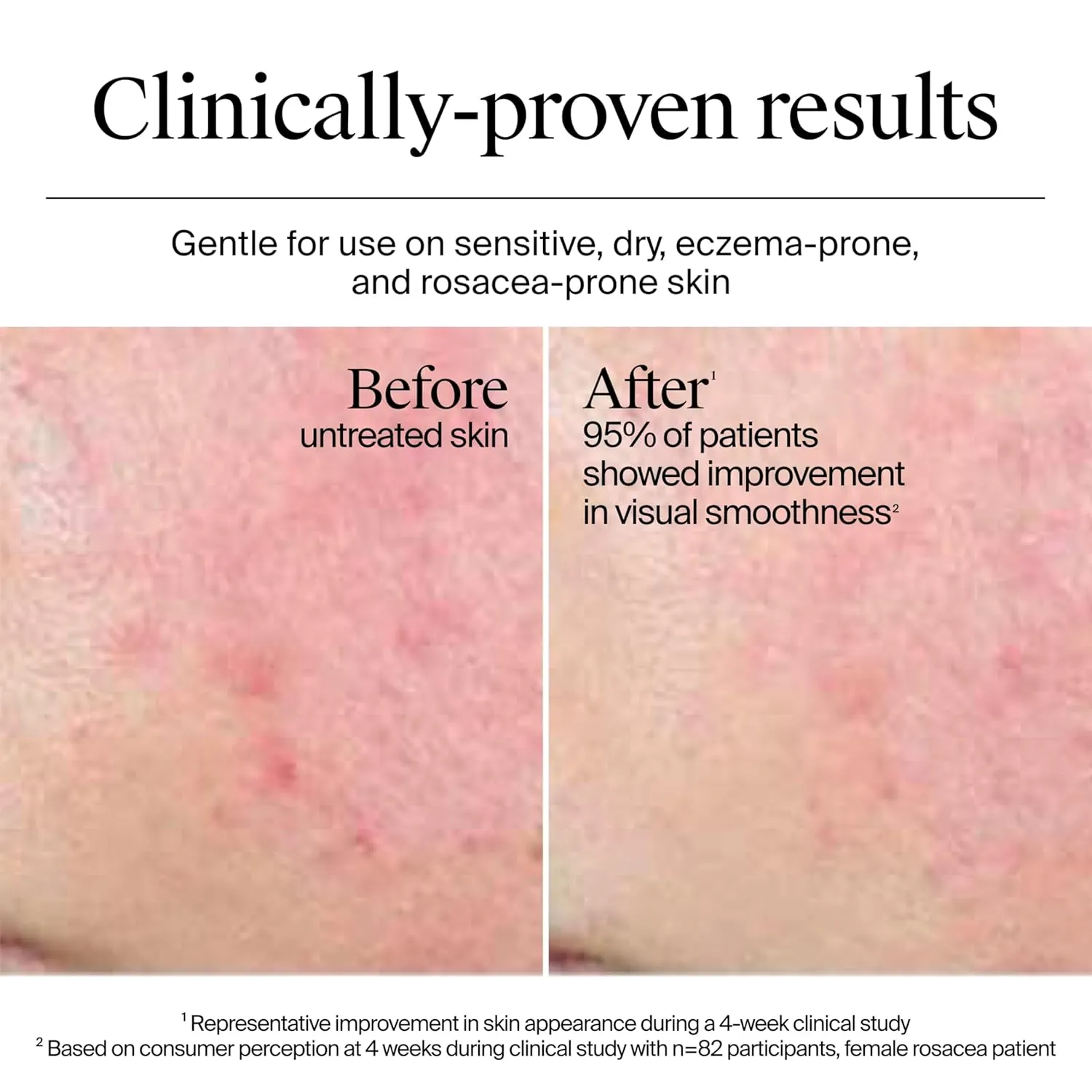 Neutrogena Hydro Boost Water Cream detail article visual